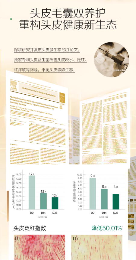 Spes 诗裴丝多肽蓬蓬瓶洗发水 控油蓬松去屑止痒洗发露|Spes Peptide Shampoo Oil Control Volumizing Anti-Dandruff