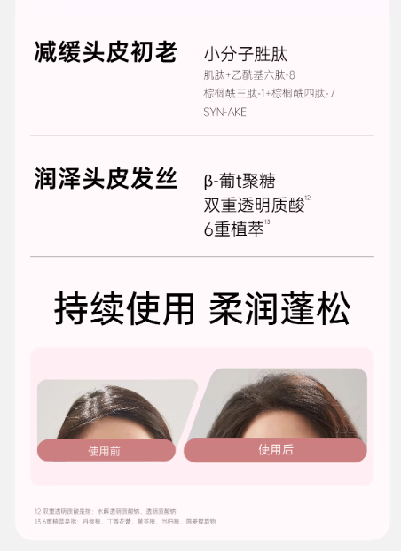 Spes 诗裴丝海盐洗头膏 控油蓬松去屑止痒 头皮磨砂膏 男女适用|Spes Sea Salt Scalp Scrub Shampoo, Oil Control Volumizing Anti-Dandruff, Gentle Exfoliation